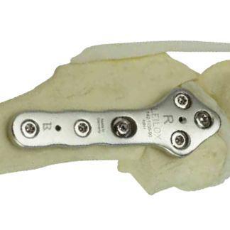 TPLO Locking Plate