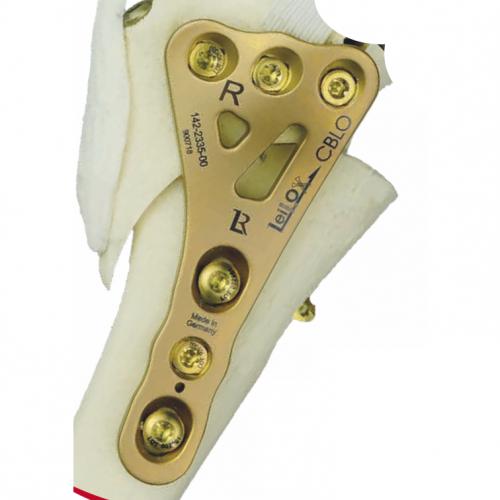 CBLO Leilox Locking System